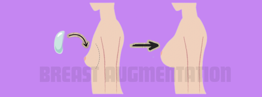 Breast Augmentation (Boob Job) - Dr. Nanthini Aesthetic & Reconstructive Surgery